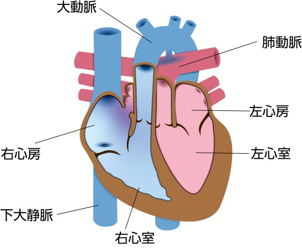 完全大血管転位症（TGA）の模式図。大動脈が右心室から、肺動脈が左心室から起始し、本来とは逆に接続している状態を示している